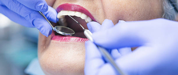 Best Broken or Chipped Tooth Repair in North Haverhill, NH
