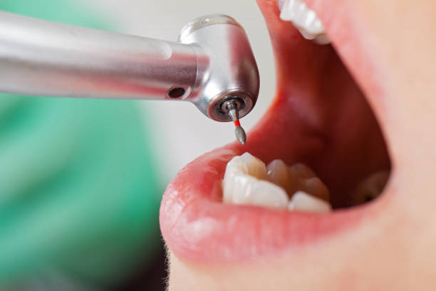 Best Emergency Treatment for Oral Infections in North Haverhill, NH